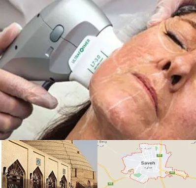 آموزش هایفوتراپی در ساوه