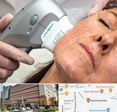 آموزش هایفوتراپی در سهروردی 