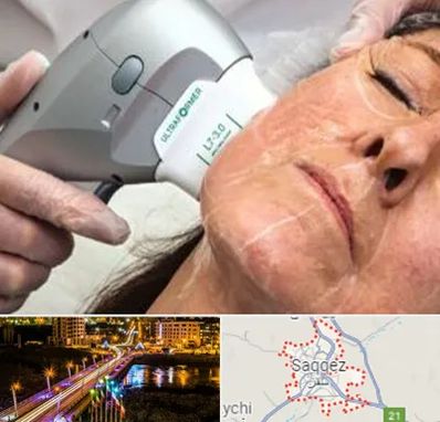 آموزش هایفوتراپی در سقز