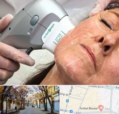 آموزش هایفوتراپی در تربیت تبریز