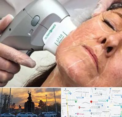 آموزش هایفوتراپی در میدان حر 