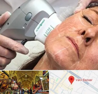 آموزش هایفوتراپی در بازار وکیل شیراز