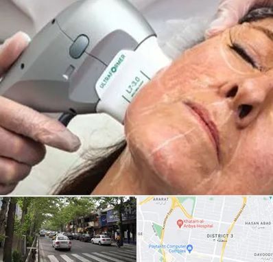 آموزش هایفوتراپی در ظفر 