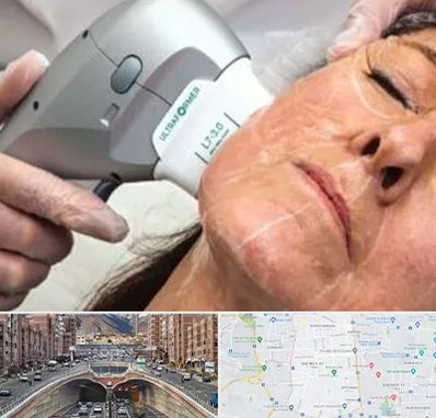 آموزش هایفوتراپی در منطقه 10 تهران 