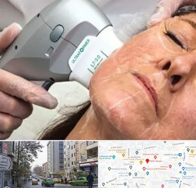 آموزش هایفوتراپی در فاطمی 