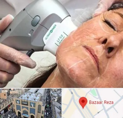 آموزش هایفوتراپی در بازار رضا مشهد