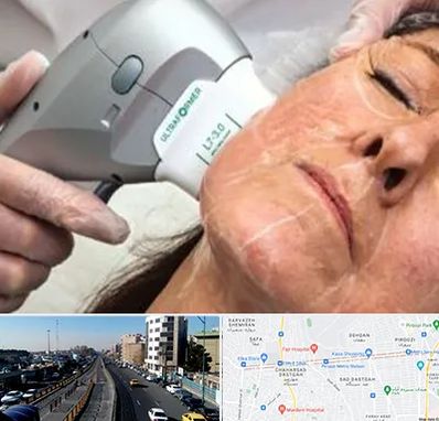 آموزش هایفوتراپی در پیروزی 