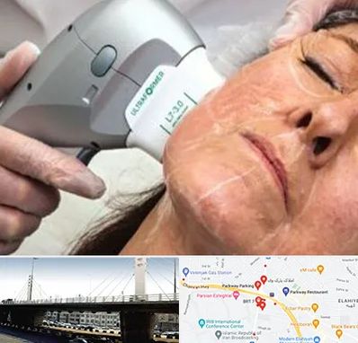 آموزش هایفوتراپی در پارک وی 