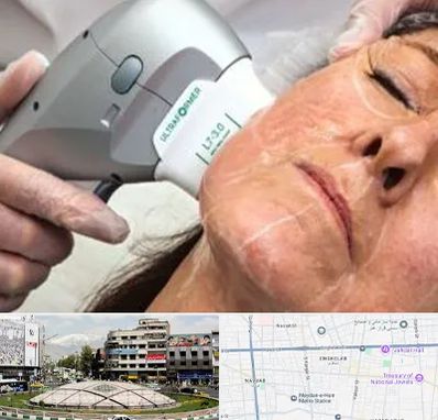 آموزش هایفوتراپی در مرکز تهران