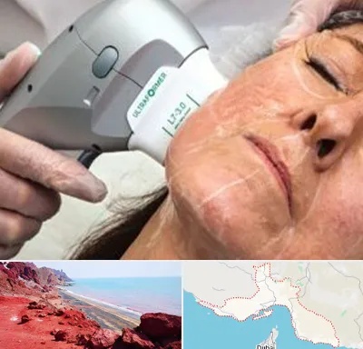 آموزش هایفوتراپی در هرمزگان