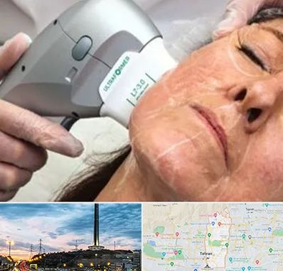 آموزش هایفوتراپی در منطقه 2 تهران 