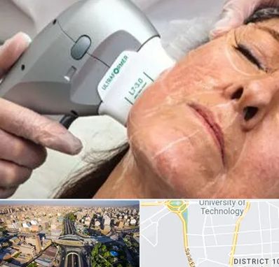 آموزش هایفوتراپی در استاد معین 