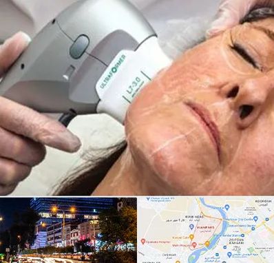 آموزش هایفوتراپی در کیانپارس اهواز 