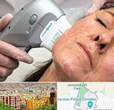 آموزش هایفوتراپی در نیاوران 