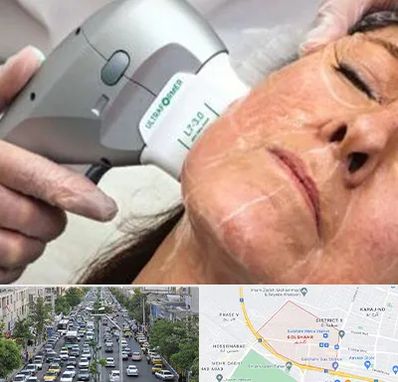 آموزش هایفوتراپی در گلشهر کرج 