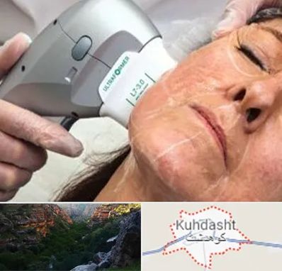 آموزش هایفوتراپی در کوهدشت