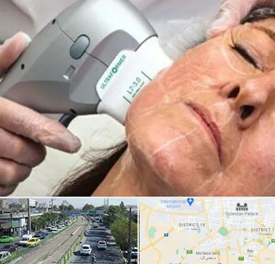 آموزش هایفوتراپی در جنوب تهران 