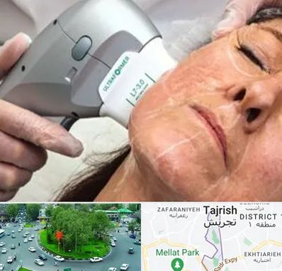 آموزش هایفوتراپی در تجریش 