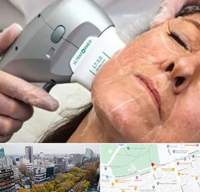 آموزش هایفوتراپی در بلوار کشاورز 