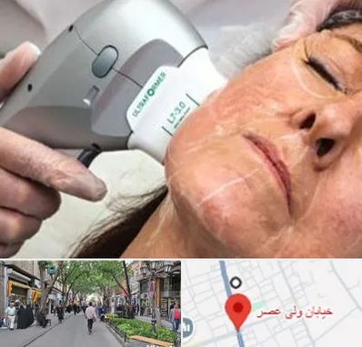 آموزش هایفوتراپی در ولیعصر شهریار