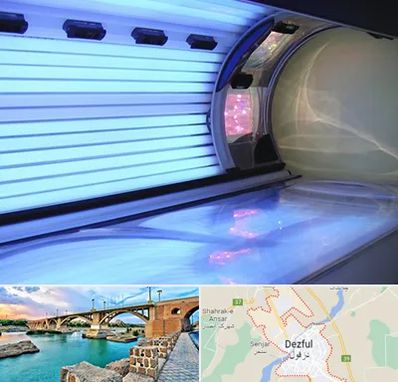 سولاریوم در دزفول