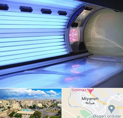 سولاریوم در میانه