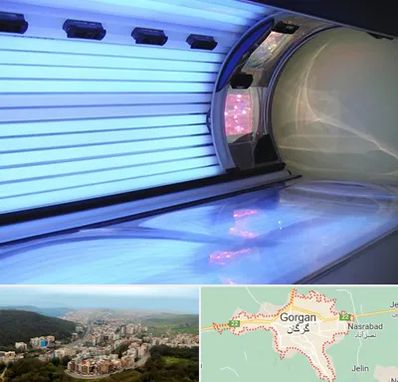 سولاریوم در گرگان