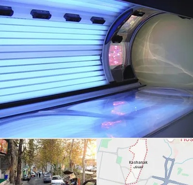 سولاریوم در کاشانک