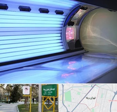 سولاریوم در تهران ویلا