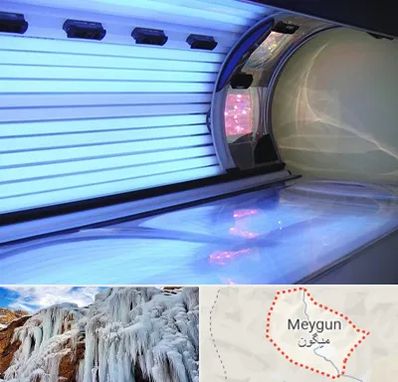 سولاریوم در میگون