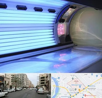 سولاریوم در زیتون کارمندی اهواز 