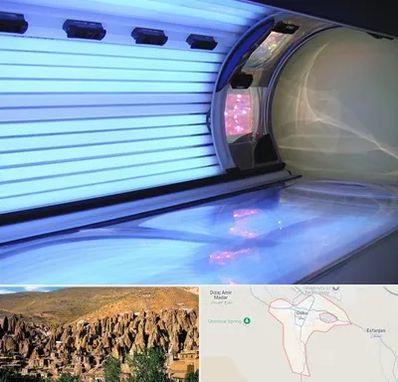 سولاریوم در اسکو