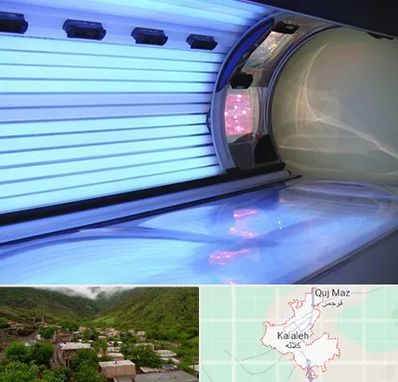 سولاریوم در کلاله