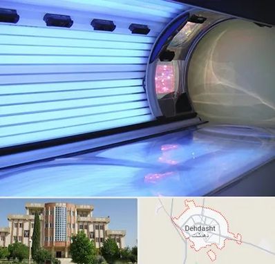 سولاریوم در دهدشت