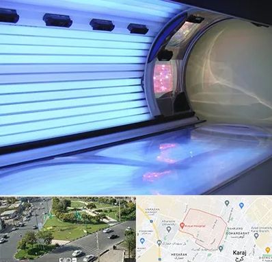 سولاریوم در شاهین ویلا کرج 