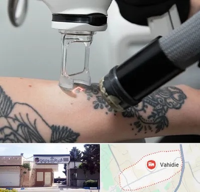 ریمو تاتو در وحیدیه شهریار