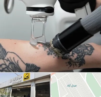 ریمو تاتو در عبدل آباد