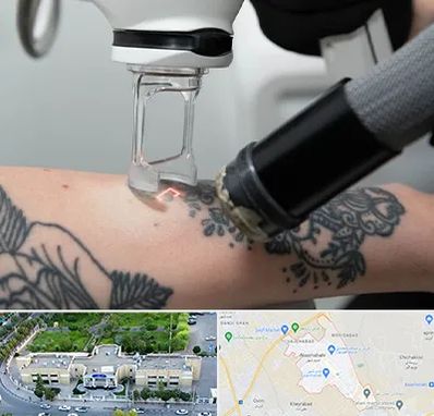 ریمو تاتو در نسیم شهر