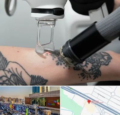 ریمو تاتو در لاله پارک تبریز