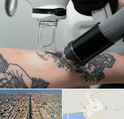 ریمو تاتو در بندر ماهشهر