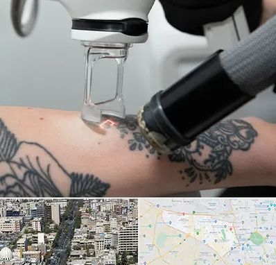 ریمو تاتو در منطقه 18 تهران 