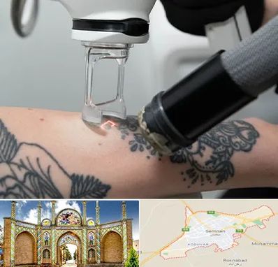 ریمو تاتو در سمنان