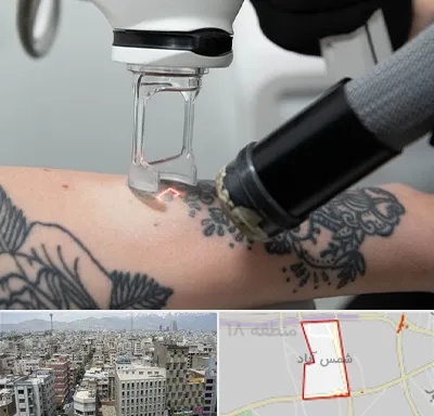 ریمو تاتو در شمس آباد تهران