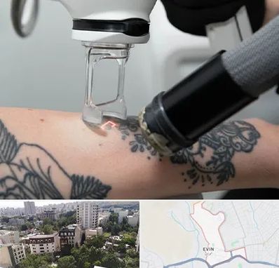 ریمو تاتو در اوین