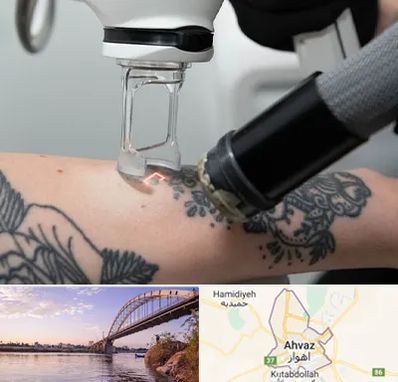 ریمو تاتو در اهواز