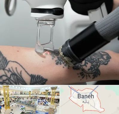 ریمو تاتو در بانه