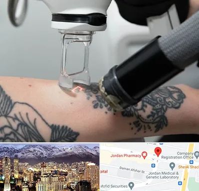 ریمو تاتو در جردن 