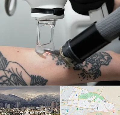 ریمو تاتو در منطقه 4 تهران 