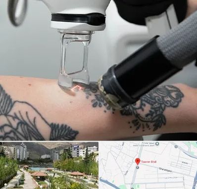 ریمو تاتو در بلوار تعاون