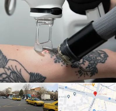 ریمو تاتو در شهناز تبریز